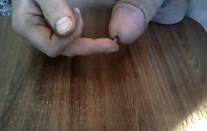 Urethra
