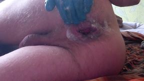 self-fisting of a prolapsed ass hole