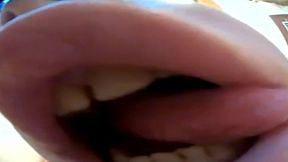 Vore Fish Eye camera 720HD