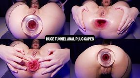 huge tunnel anal plug gapes prolapse and orgasm close up hardcore delights with big transparent plug, doggystyle and farts ils108