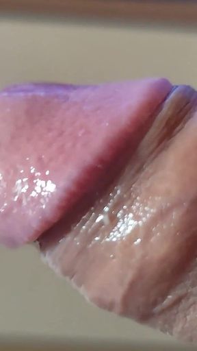 Strange Lumpy Cock with a Gigantic Head.