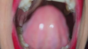 The mouth tour unwashed for three weeks.