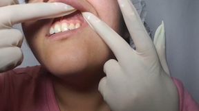 Morning check for yellow teeth