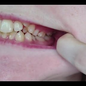 My Mouth, Teeth, Tongue and Throat up Close