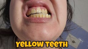 Washing My Crooked Yellow Teeth – Extreme Close Up Oral Hygiene Fetish – Brushing Dirty Natural Teeth – Realistic Yellow Teeth Fetish Video with Sounds