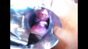 Speculum Cervix & Anal Exam Great View Inside