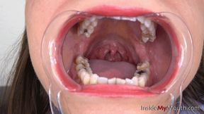 Inside My Mouth - Suzanne - Mouth retractor clip! (FULLHD quality)