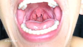 exciting uvula