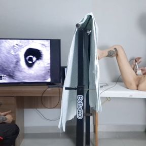 Cuckold takes wife to have an ultrasound!