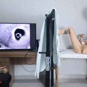 Cuckold takes wife to have an ultrasound!