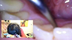 Tech-Savvy Dental Care: A Vore Day Adventure 1080HD