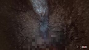 too thick fetish scenes compression. anus! uncensored! in close contact! 6 person pack(mix-44/fetis.jp)