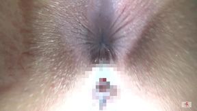 too thick fetish scenes compression. anus! uncensored! in close contact! 6 person pack(mix-44/fetis.jp)