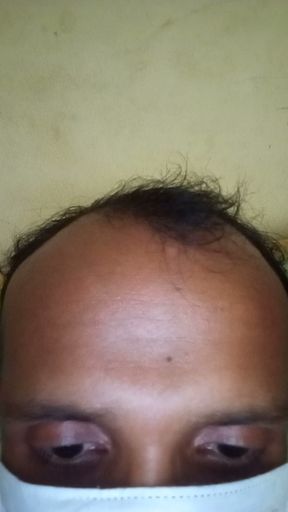 Anybody like me