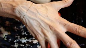 The large and numerous veins in my hands, even moving like a snake!