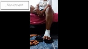 Brig_Sexi_Hot Itchy dry foot other foot wrapped up