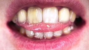 Tiny 1:700 Man Trapped by My Red Toes & Dripping Saliva