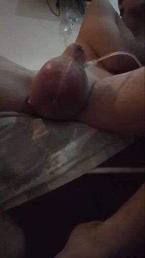 Key moment from &quot;My journey of having 2L of D5NS turn my sac into a hot air balloon  (part1)&quot;