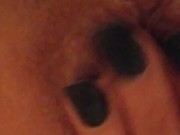 Prolapse play closeup