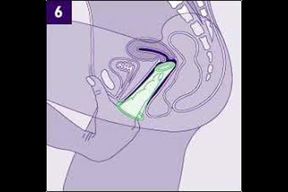 Don't use the wrong way Condom Use Mistakes (Hindi)