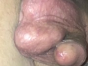 Young Furry ass prostate massage