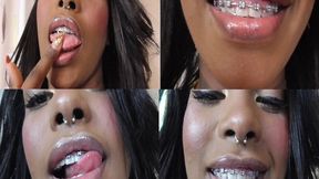 Ebony Teeth Brace Fetish! mp4