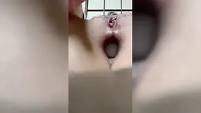 Ping pong ball in anus