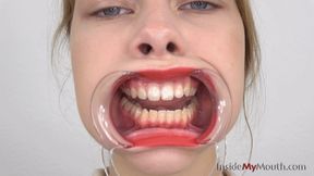 Inside My Mouth - Anna - Mouth retractor clip (MOBILE quality)