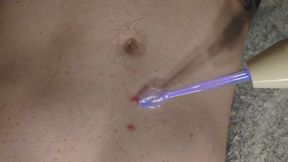 Electro stim