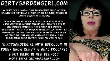 Dirtygardengirl with speculum in pussy show cervix and anal prolapse &amp_ put dildo in her peehole