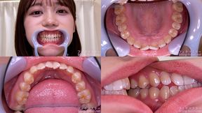 Mai Onodera - Watching Inside mouth of Japanese cute girl - MOV 1080p