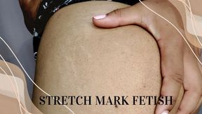 Stretch Marks Fetish