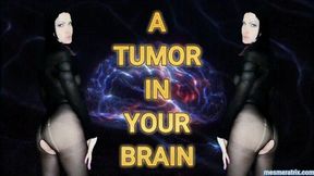 A TUMOR YOUR BRAIN