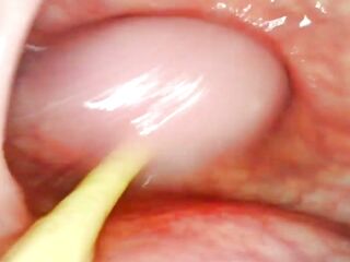 EXTRAORDINARY ANAL POV. CAMERA INSIDE HER BACKDOOR AS I POUND HER WITH MY LARGE ROD AND CUM UNFATHOMABLE INSIDE