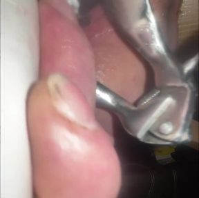 Thumtacks hurt