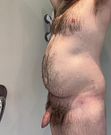 Another Big and Tight Belly Inflation with the Shower Hose
