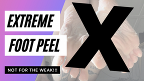 EXTREME Foot Peel