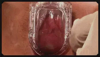 Latex Babe's Steamy Exam