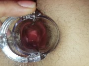 Trying To Look In My Hole - Speculum