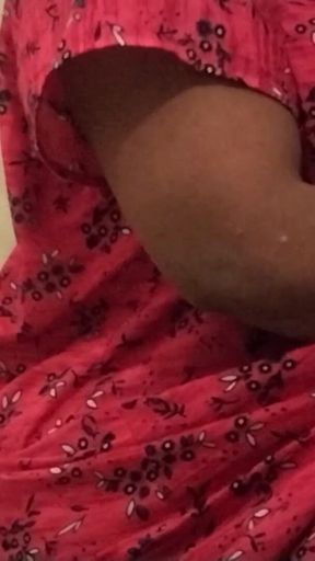 Hot Leg