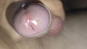 Scrotal Phimosis Results in an Extremely Hot Orgasm.