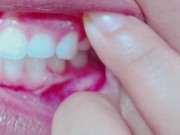 Teeth Fetish Examination