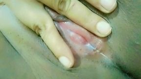 White discharge from vagina pussy hole