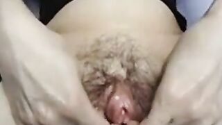 Hairy Mature Girl Masturbates on Webcam