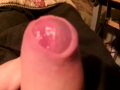 foreskin stretching,phimosis sucks