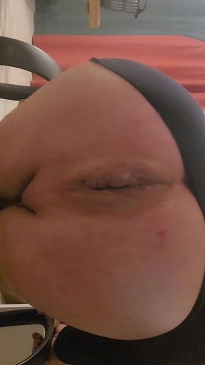 My anal