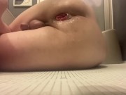 アナル拡張に励むデブ