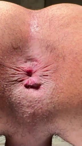 Asshole in Your Face