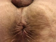 Asshole Winking 2 U Upclose Mesmerize