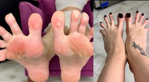 Long toes spreading, toe spread close ups in two different angles, bare feet with black toenails polish